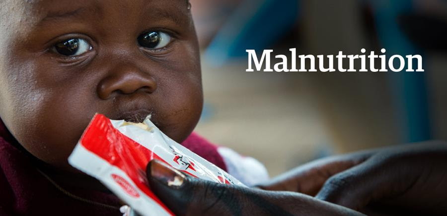 Cinq choses que vous ignorez peut-être sur la malnutrition